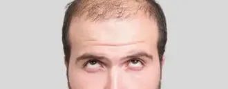 20 Fascinating Facts About Hair: Why Baldness Is Super-Masculine – And a Pubic Bush Could Be a ‘Cheating Detector’
