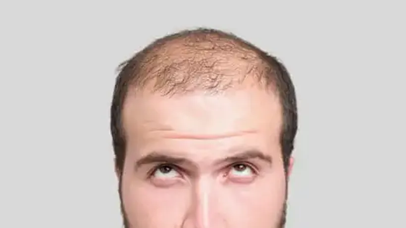 20 Fascinating Facts About Hair: Why Baldness Is Super-Masculine – And a Pubic Bush Could Be a ‘Cheating Detector’